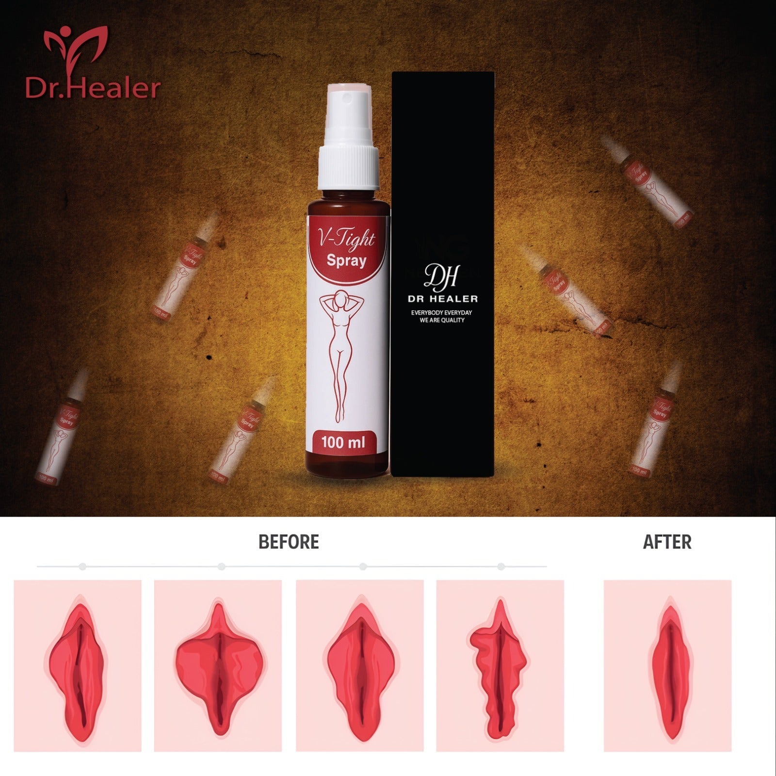 V Tightness Spray by Dr Healer